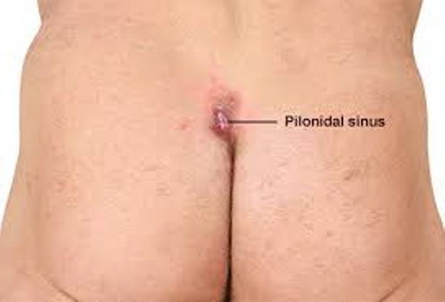 Dr.Kashid Hospital & Piles Clinic